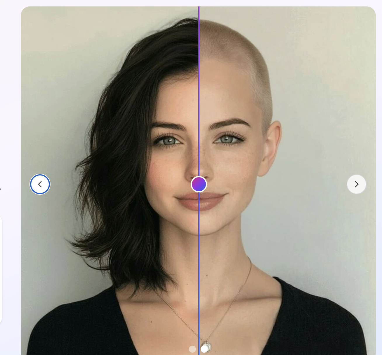 Bald hairstyle before and after example
